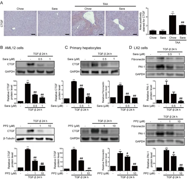 Figure 5. Src inhibitors attenuate CTGF expression. (A) Representative images of IHC staining for  CTGF in livers of TAA-injected mice treated with or without saracatinib