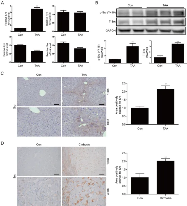 Figure 1. Expression of Src is elevated in liver tissues of thioacetamide (TAA)-injected mice and  cirrhotic livers of patients (A) Representative real-time RT-PCR analysis of mRNA expression of SRC  family kinases (Src, Fyn, Lyn, and Yes) in liver tissues