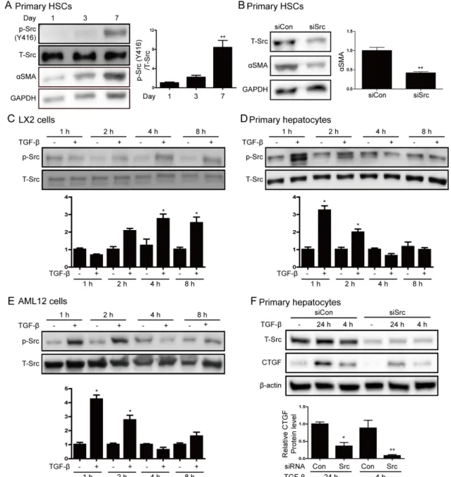 Figure 2. Src phosphorylation is increased by hepatic stellate cell activation and transforming growth  factor  β (TGF-β) stimulation