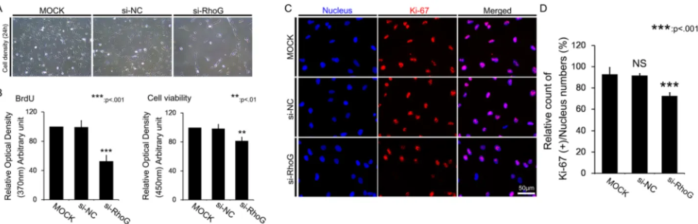Figure 6.  RhoG-silencing effects on RPE migration. (A) Representative images of cross-hair wound healing  in monolayers of RPE cells transfected with si-RhoG or control constructs