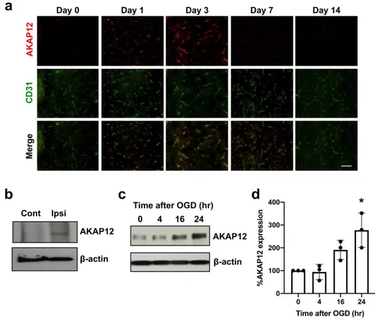 Figure 1. AKAP12 expression after stroke: (a) Double-staining of AKAP12 (red) with an endothelial  marker  CD31  (green)  showed  that  AKAP12  was  expressed  in  or  around  blood  vessels,  and  its  expression  level  transiently  increased  after  str