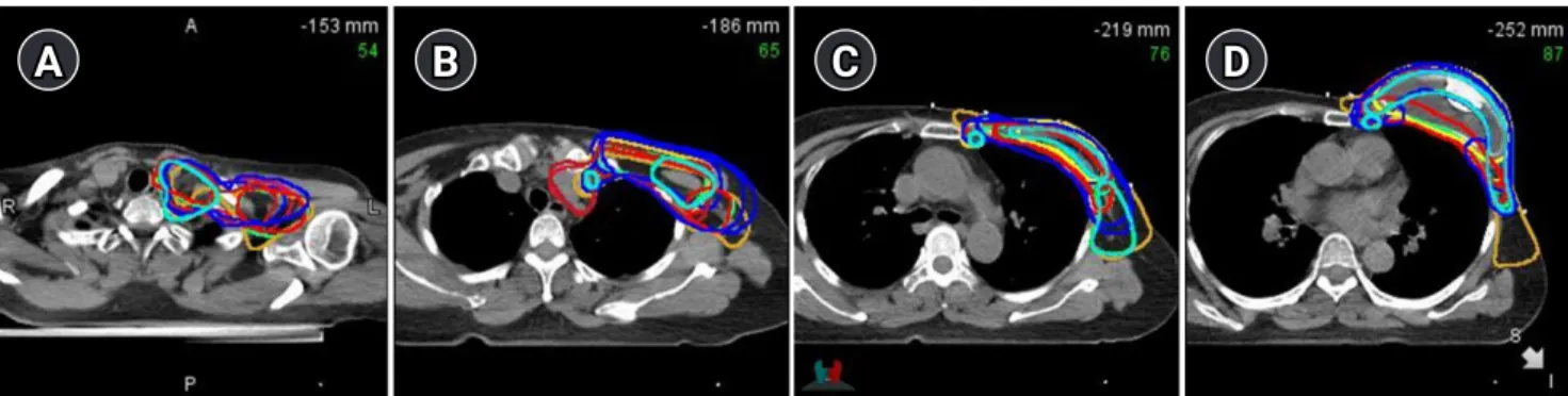 Fig. 5. Sum of all the radiation therapy structures included according to each clinical scenario