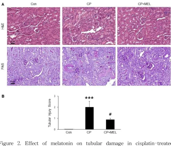 Figure 2. Effect of melatonin on tubular damage in cisplatin-treated mice. (A) Renal hematoxylin and eosin (H&amp;E) and periodic acid-schiff (PAS) stainings