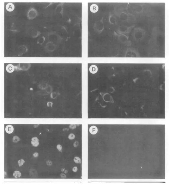 FIGURE 9. Immunofluorescent analysis of cytokeratin expression in an HCE line, (a) AE1, (b) AE3, <c) AE5, (d)Vimentin, (e) T Antigen, (f) negative control (400X magnification).