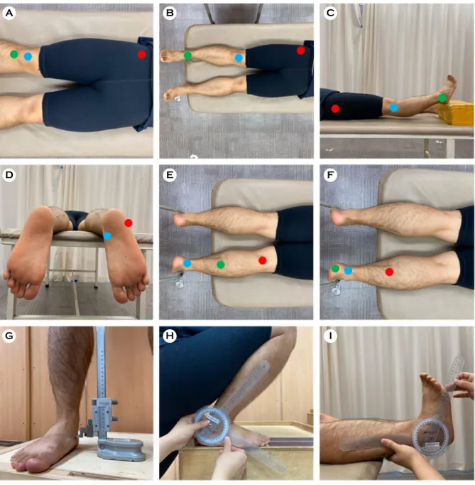 Figure 2.  Measurement procedure of static lower extremity alignment. (A), Q angle; (B), TF angle; (C), genu recurvatum; (D), tibia torsion; (E), tibia  varum; (F) rear foot angle; (G) navicular drop; (H) WB DF ROM, weight bearing dorsi flexion range of mo