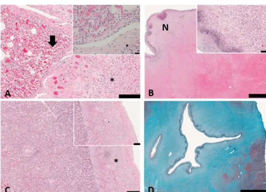 Fig. 2. Histopathological findings of the lesions. (A) Suppurative  pneu-monia (black arrow, inset) and  fib-rosis with neovascularization  (as-terisk, inset) on lung surface