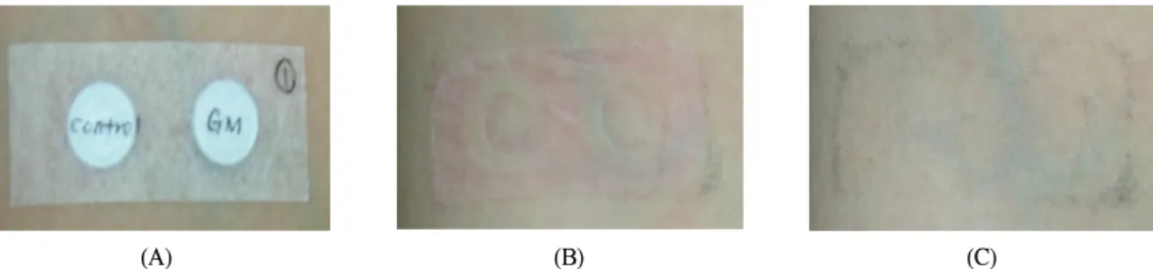 Fig.  2.  Effect  of  essential  oil  extracted  from  erect  bur-marigold  (Bidens  tripartita  L.)