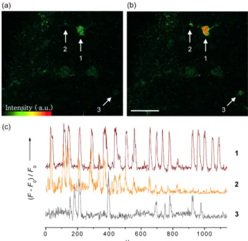 Figure 3은 살아있는 쥐의 뇌 조직 절편에 10 µM의 ACa1-  AM으로 염색한 후 hypothalamic  인근 지역에 존재하는  astro-cyte에서 진행되는 자발적인 칼슘 wave를 이광자 현미경을  이용하여 실시간으로 촬영해 얻은 영상을 시간대 별로 정리 한 것이다