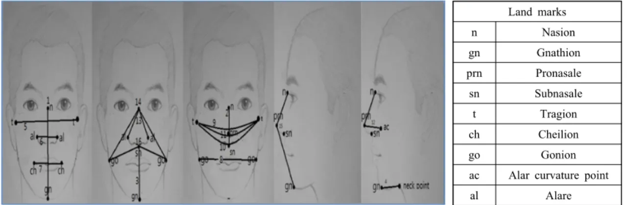 Fig 3. Landmarks used and Facial Dimensions measured for the study