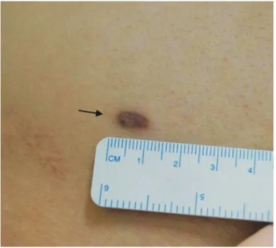 Figure 2.  (A)  Low-magnification  view  of  superficial  and