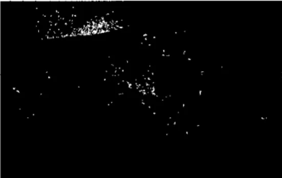 Figure 3. ， Well-delirnited ， 킹 oguJated ，P 얘 gollfÙ exudative 따 ærs