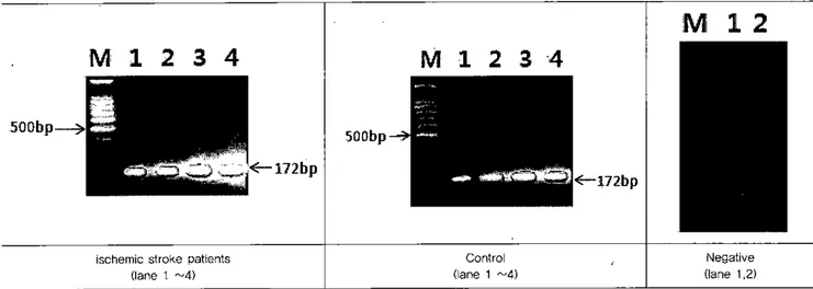 Figure 1. Agarose gel electrophoresis of TLR 4 PCR producæ. [Lane M，molec 버 ar marker(loo bp !adder) ，DNA SIZE: 172 bp]