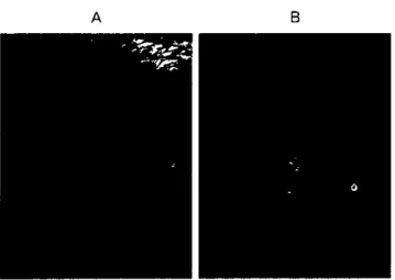 Figure 2. A. Wel1 delimited non-caseating n 와 {ed tubercles