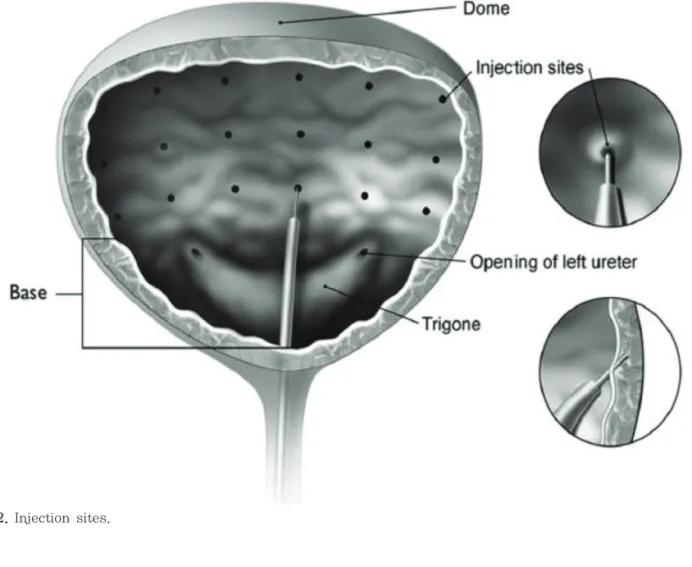 Figure 2. Injection sites.