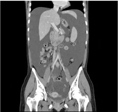Figure 2.  Pathologic  report  for  ovarian  mass  after  first