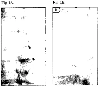 Figure 1. Fluoroscopic ìmages of oblìque (A) and lateral (B) durîng ìntravascular :înjectìon