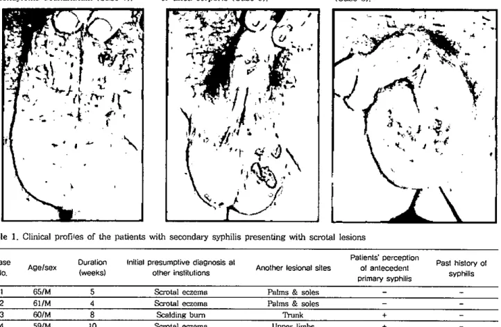 Table 1. Clinical profi1es of the patients with second81'Y 양 philis presenting with scrot.al lesions