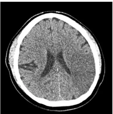 Figure 1. Brain computed tomography