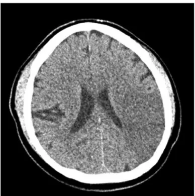 Figure 1. Brain computed tomography