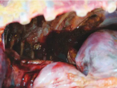 Figure 4.  The  rugged  margin  of  stomach  showed  nothing