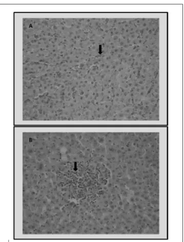 Figure 2. Representative photographs of liver sections from the high-dose group stained with hematoxylin-eosin