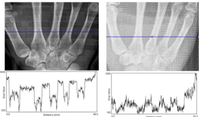 Fig. 2. The radiography and plot profile (a) the cast of 3D Printing (b) the conventional cast 