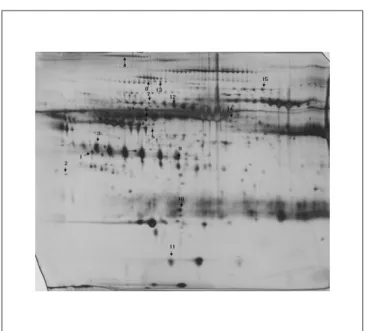 Fig. 2. 2D map of proteins expression pattern in serum of subjects. PI, 4.0-7.0 and molecular weight, 10-200 kDa