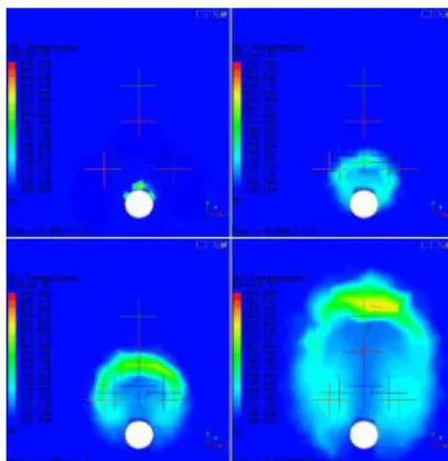 Figure 1. 2-D temperature fields at the reaction zone [2]  The wastage rates for the neighboring tubes adjacent to  the initially ruptured tube are calculated by considering 