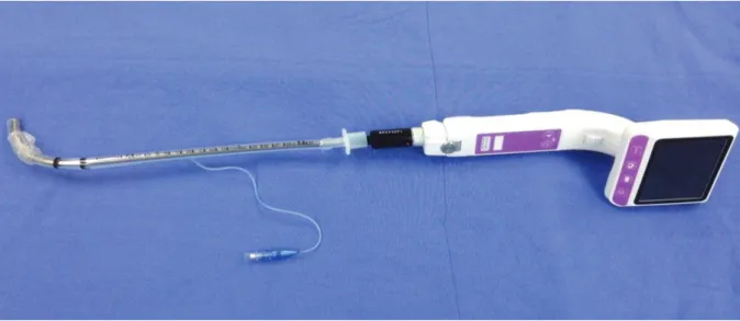 Fig. 2. Optiscopic view of the trachea, showing  multiple cobblestone-like appearance masses  (arrows) protruding into the tracheal lumen, and  also diffuse hemorrhage in the subglottic lesion due  to multiple intubation attempts.
