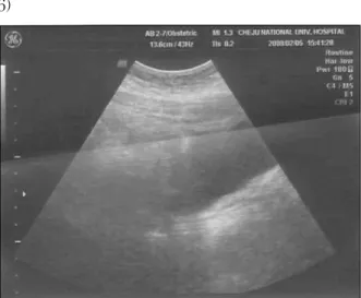 Figure 2. transabdominal ultrasonography