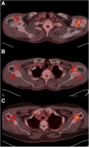 Fig. 1   Standardized uptake values measured at the four regions of  interest from the attenuation corrected axial images on  18 F-FDG PET/