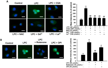 Fig. 4. Effects of chlorogenic acid (CGA) and store-operated channel (SOC) blockers on lysophosphatidylcholine (LPC)-induced ROS  generation in human umbilical vein endothelial cells (HUVECs)