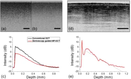 Fig.  3.  Comparison between  dermoscopy  guided MF-OCT  and  conventional  OCT  in a  tissue  phantom  and  sensitivity  analysis  of  dermoscopy  guided  MF-OCT  in  the  human  skin