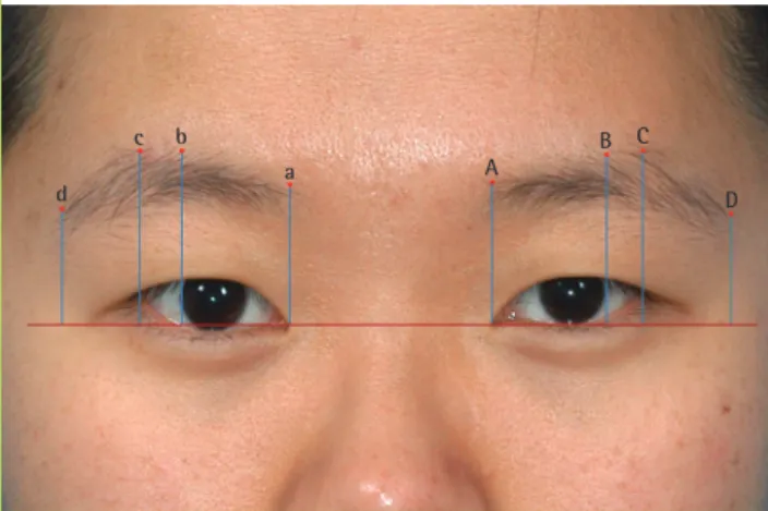 Fig. 1. Photogrammetric analysis