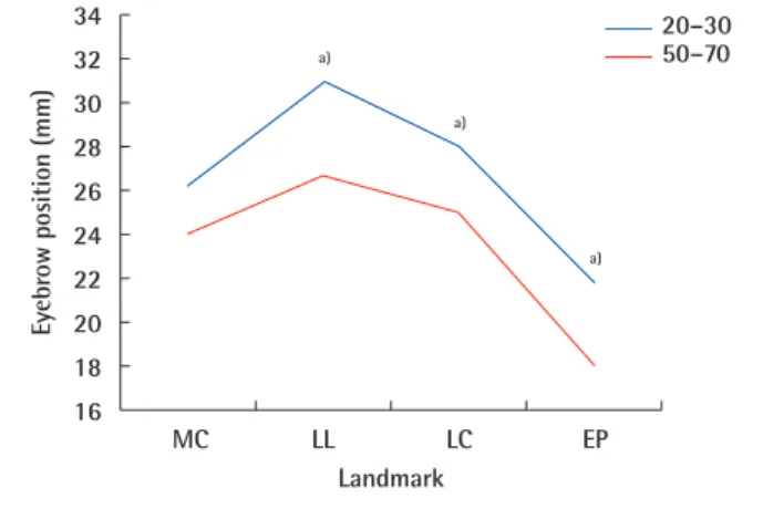 Fig. 7. Eyebrow height with eyes opened maximally