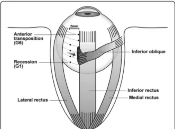 Fig. 1 Surgical methods and points in each group. Surgery involved reinsertion of the IO muscle at various points along the temporal aspect of the IR muscle