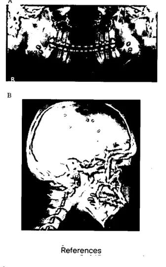 Figure 4. Post operative jaws operation. Panoramic view{A) ‘ Cephalogram (B)