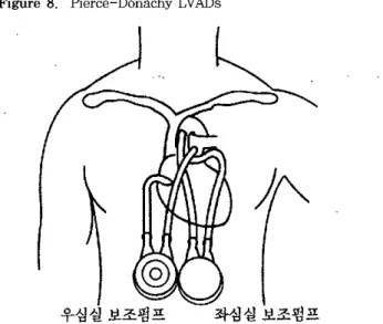 Figure 8. Pierce-Donachy LVADs
