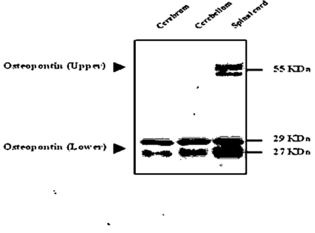 Figure 1. Wcstern blot analysis of Osteoponlin in thc central nervous system of mouse