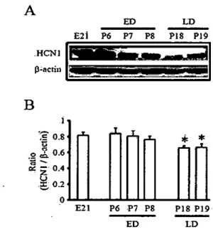 Figure 1. Age-dependent decrease in expression leveIs of HCNl is observed in the developing hippocampus of rats