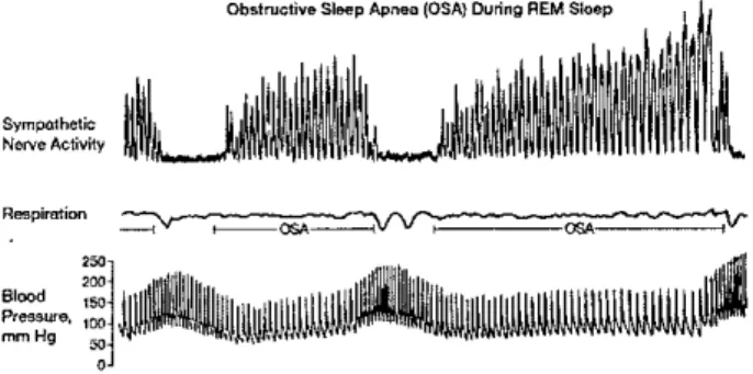 Figure 2. Changes of sympathetic nerve activity and blood pressure in the individual with obstructive sleep apnea (OSA)