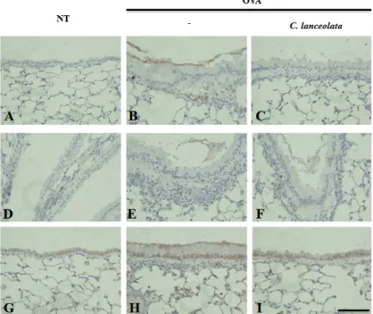Fig.  4.  Immunohistochemical  analyses  of  C.  lanceola- lanceola-ta  extract  treated  lung  tissues  in  ovalbumin  (OVA)-challenged  mice