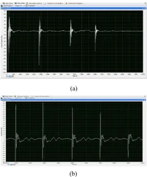 Fig. 6 Signal comparison between existing  sensor and improved sensor for fuel pump 