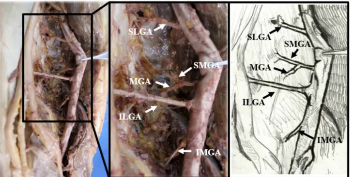 Fig. 1. Representative image of the branches of the genicular artery. ILGA, inferior lateral genicular artery; IMGA, inferior medial genicular artery; MGA, middle genicular artery; SLGA, superior lateral genicular artery; SMGA, superior medial genicular ar