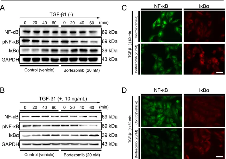 Figure 5. Regulation of NF-kB signaling pathway after treatment of bortezomib. Western blot analysis of the NF-κB signaling pathway  in the absence A or presence B of TGF-β1