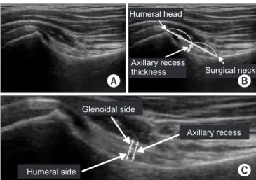 Table 1. The thickness of axillary recess recorded by the two raters, depending on three different angles of shoulder  abduction