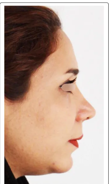 Fig. 6 Postoperative profile view