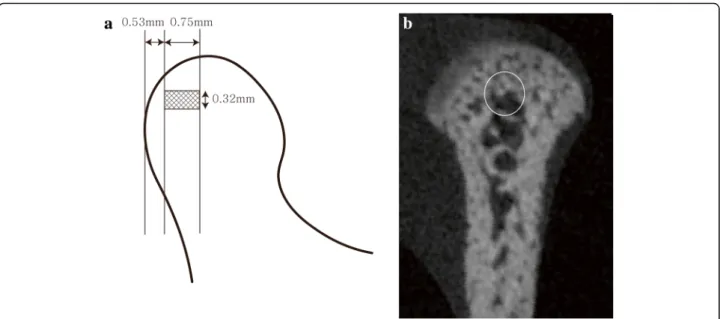 Fig. 3 Reference planes (a) and reference points (b). Plane S refers to a plane passing through P1, P2, and P6