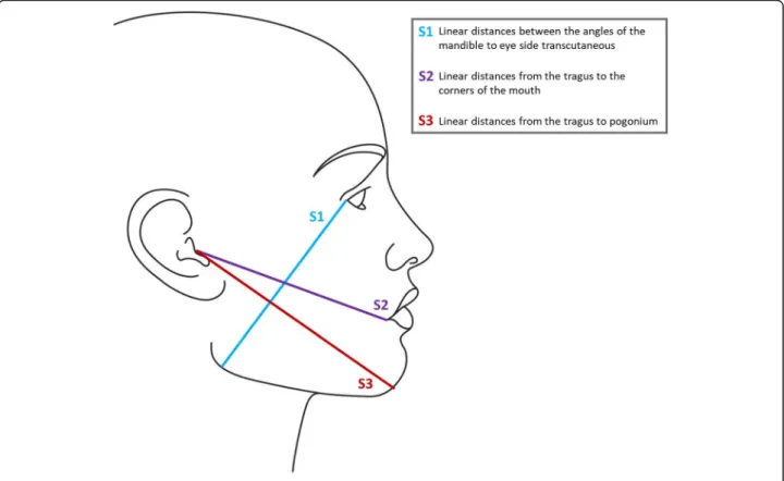 Fig. 3 Assessing swelling level by Gabka and Matsumara technique