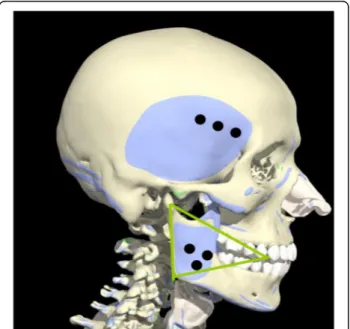 Fig. 10 Areas colored with blue represent temporal and masseter muscles, black point represent injection point, and approximately 10 BU is injected to each injection point